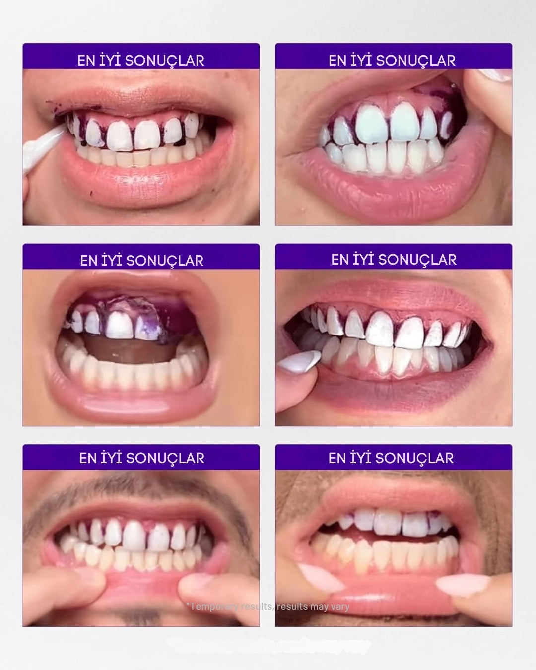 V34 SMILE™ Diş Beyazlatma Şeritleri